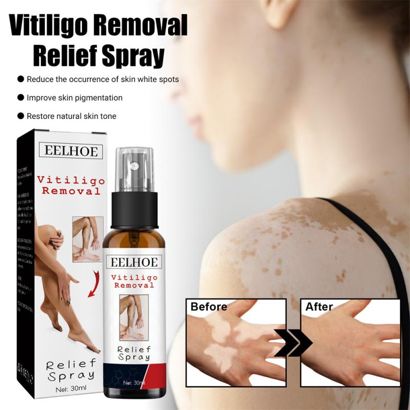 Vitiligo-Spray 30ml institut hydratant pour la peau, réparation de la peau, du visage, du corps, estompe les taches blanches